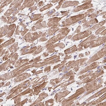 Anti-FZD2 antibody produced in rabbit Prestige Antibodies&#174; Powered by Atlas Antibodies, affinity isolated antibody, buffered aqueous glycerol solution