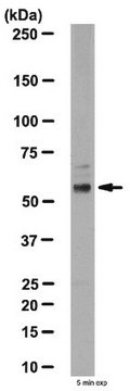 Anti-Neurotensin Receptor 2 Antibody from rabbit, purified by affinity chromatography