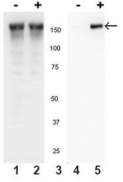 Anti-phospho-EGFR (Tyr845) Antibody Upstate&#174;, from rabbit