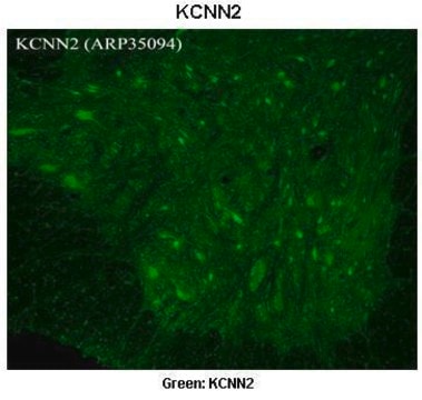 Anti-KCNN2 antibody produced in rabbit IgG fraction of antiserum