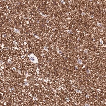 Anti-NLRP11 antibody produced in rabbit Prestige Antibodies&#174; Powered by Atlas Antibodies, affinity isolated antibody, buffered aqueous glycerol solution