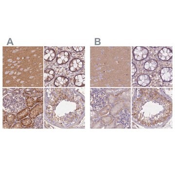 Anti-ADD1 antibody produced in rabbit Prestige Antibodies&#174; Powered by Atlas Antibodies, affinity isolated antibody, buffered aqueous glycerol solution