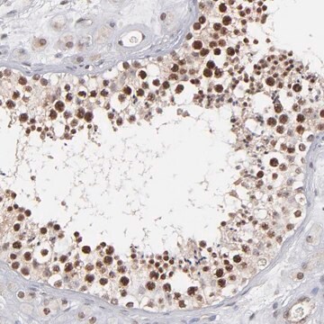 Anti-RGS6 antibody produced in rabbit Prestige Antibodies&#174; Powered by Atlas Antibodies, affinity isolated antibody, buffered aqueous glycerol solution