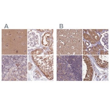 Anti-NAXE antibody produced in rabbit Prestige Antibodies&#174; Powered by Atlas Antibodies, affinity isolated antibody, buffered aqueous glycerol solution