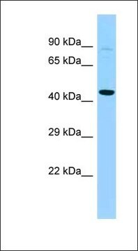 Anti-PFKFB4 antibody produced in rabbit affinity isolated antibody