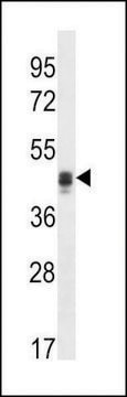 ANTI-CALU(C-TERMINAL) antibody produced in rabbit affinity isolated antibody, buffered aqueous solution