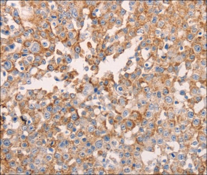 Anti-GNA11 antibody produced in rabbit affinity isolated antibody