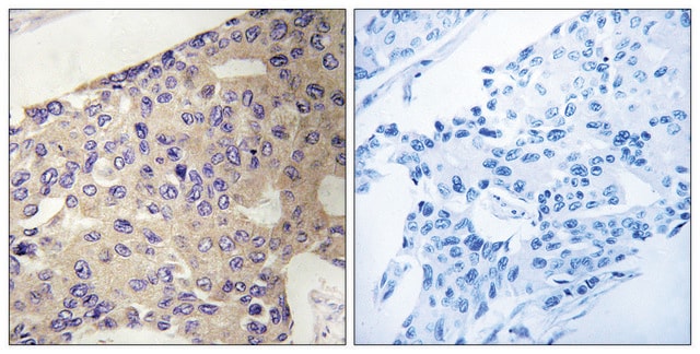 Anti-PEX10 antibody produced in rabbit affinity isolated antibody