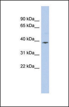 Anti-APOL6 antibody produced in rabbit affinity isolated antibody