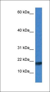 Anti-ISCU antibody produced in rabbit affinity isolated antibody