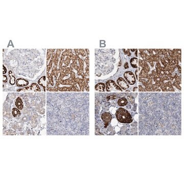 Anti-PCCB antibody produced in rabbit Prestige Antibodies&#174; Powered by Atlas Antibodies, affinity isolated antibody, buffered aqueous glycerol solution