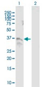 ANTI-TM6SF2 antibody produced in mouse purified immunoglobulin, buffered aqueous solution