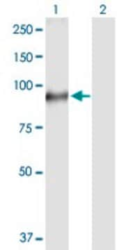 Anti-TGM1 antibody produced in rabbit purified immunoglobulin, buffered aqueous solution