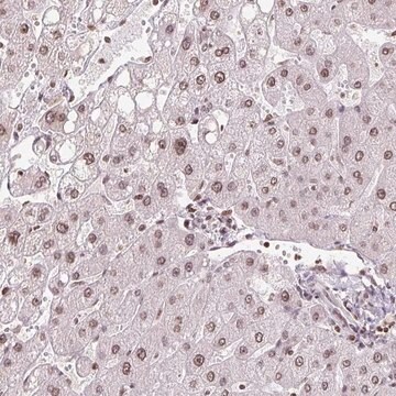 Anti-RNF181 antibody produced in rabbit Prestige Antibodies&#174; Powered by Atlas Antibodies, affinity isolated antibody, buffered aqueous glycerol solution