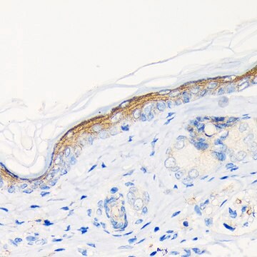 Anti-Involucrin Antibody, clone 8H7B3, Rabbit Monoclonal