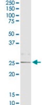 Anti-C1QB antibody produced in rabbit purified immunoglobulin, buffered aqueous solution