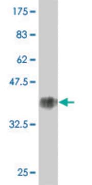 Monoclonal Anti-KRT1 antibody produced in mouse clone 2A7, purified immunoglobulin, buffered aqueous solution