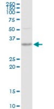 抗SNX11抗体 ウサギ宿主抗体 purified immunoglobulin, buffered aqueous solution