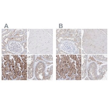 Anti-UFL1 antibody produced in rabbit Prestige Antibodies&#174; Powered by Atlas Antibodies, affinity isolated antibody, buffered aqueous glycerol solution, ab3