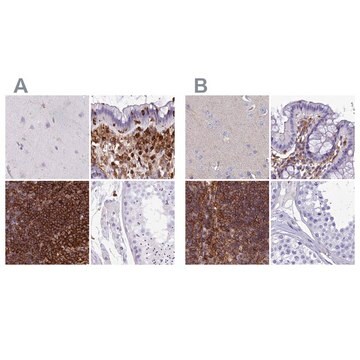 Anti-PPP1R18 antibody produced in rabbit Prestige Antibodies&#174; Powered by Atlas Antibodies, affinity isolated antibody, buffered aqueous glycerol solution