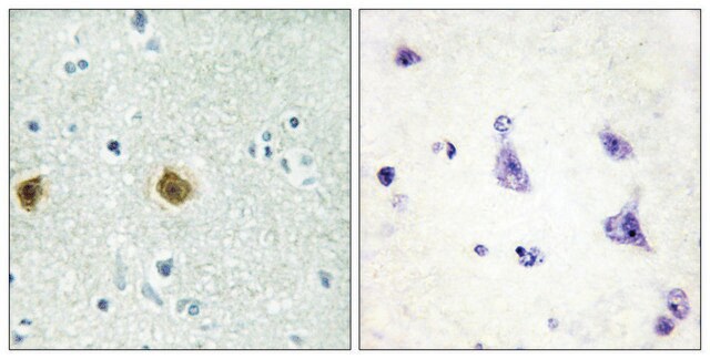 Anti-NDUC2 antibody produced in rabbit affinity isolated antibody