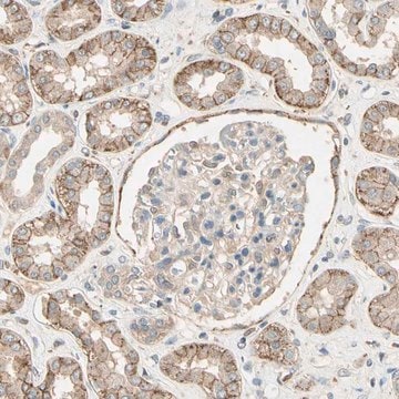 Anti-CDH6 antibody produced in rabbit Ab2, Prestige Antibodies&#174; Powered by Atlas Antibodies, affinity isolated antibody, buffered aqueous glycerol solution