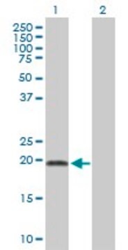 Anti-ADI1 antibody produced in mouse purified immunoglobulin, buffered aqueous solution