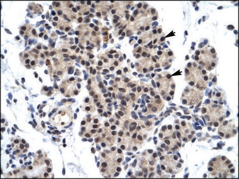 Anti-ZNF318 antibody produced in rabbit affinity isolated antibody