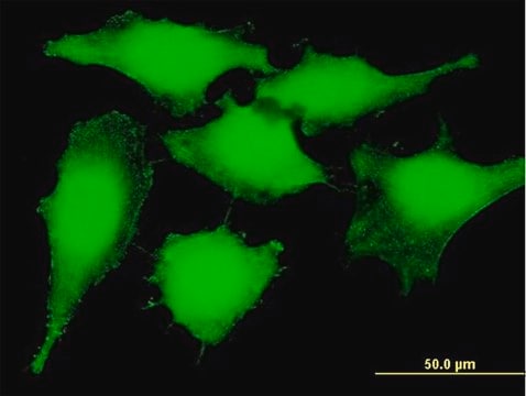 Anti-PSMB5 antibody produced in mouse purified immunoglobulin, buffered aqueous solution