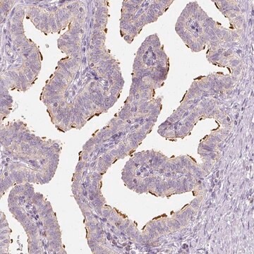 Anti-LCA5 antibody produced in rabbit Prestige Antibodies&#174; Powered by Atlas Antibodies, affinity isolated antibody, buffered aqueous glycerol solution