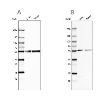 Anti-GC antibody produced in rabbit Prestige Antibodies&#174; Powered by Atlas Antibodies, affinity isolated antibody, buffered aqueous glycerol solution