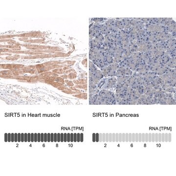 Anti-SIRT5 antibody produced in rabbit Prestige Antibodies&#174; Powered by Atlas Antibodies, affinity isolated antibody, buffered aqueous glycerol solution, Ab1