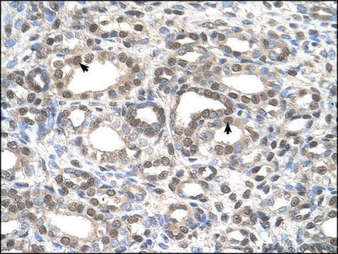 Anti-DFNA5 antibody produced in rabbit IgG fraction of antiserum