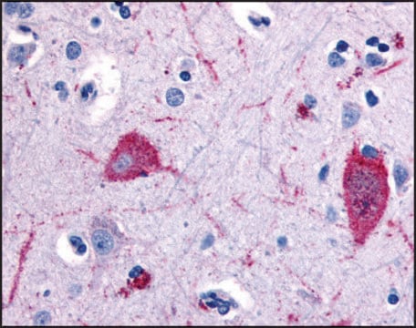 Anti-HTR5A (AB1) antibody produced in rabbit affinity isolated antibody, buffered aqueous solution