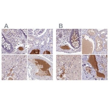 Anti-HGFAC antibody produced in rabbit Prestige Antibodies&#174; Powered by Atlas Antibodies, affinity isolated antibody, buffered aqueous glycerol solution