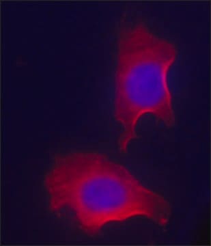 Anti-RACK1 (N-terminal) antibody produced in rabbit IgG fraction of antiserum, buffered aqueous solution