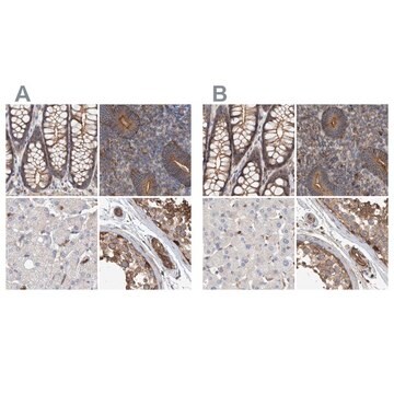 Anti-SPECC1 antibody produced in rabbit Prestige Antibodies&#174; Powered by Atlas Antibodies, affinity isolated antibody, buffered aqueous glycerol solution, Ab1