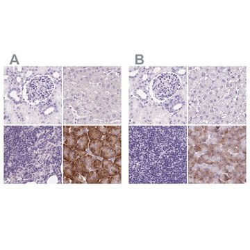 Anti-PDIA2 antibody produced in rabbit Prestige Antibodies&#174; Powered by Atlas Antibodies, affinity isolated antibody, buffered aqueous glycerol solution