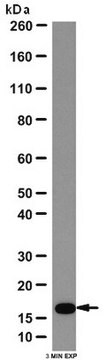 抗线粒体分裂1蛋白（Fis1）抗体 from rabbit, purified by affinity chromatography