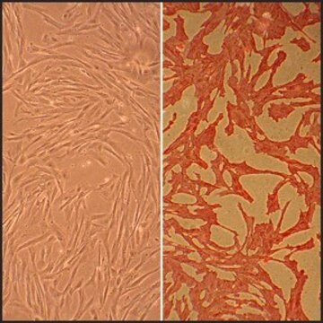 Canine Aortic Smooth Muscle Cells: CnAOSMC (Cryovial)