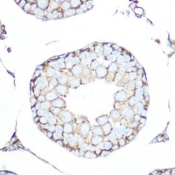 Anti-SSTR5 antibody produced in rabbit