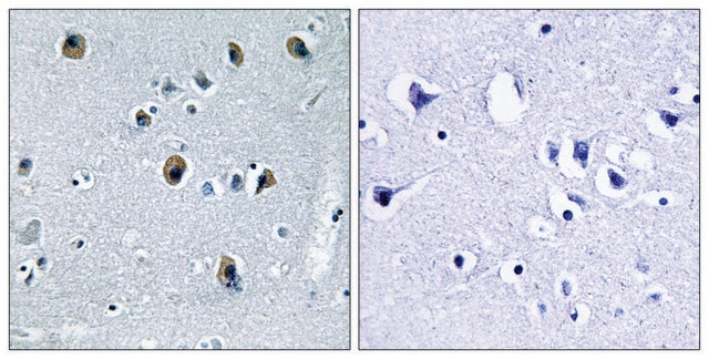 Anti-Collagen XX &#945;1 antibody produced in rabbit affinity isolated antibody