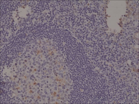 Anti-Spastin antibody, Rabbit monoclonal recombinant, expressed in HEK 293 cells, clone RM346, purified immunoglobulin