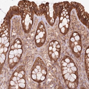 Anti-RASA3 antibody produced in rabbit Prestige Antibodies&#174; Powered by Atlas Antibodies, affinity isolated antibody, buffered aqueous glycerol solution