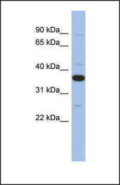 Anti-MYD88 antibody produced in rabbit affinity isolated antibody