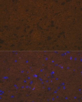 Anti-Talin 2 Antibody, clone 7D1Y0, Rabbit Monoclonal