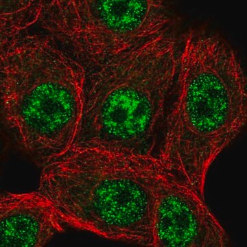 Anti-STK19 antibody produced in rabbit Prestige Antibodies&#174; Powered by Atlas Antibodies, affinity isolated antibody