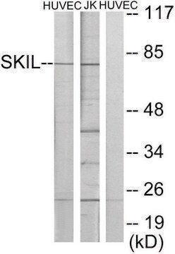 Anti-SKIL antibody produced in rabbit affinity isolated antibody