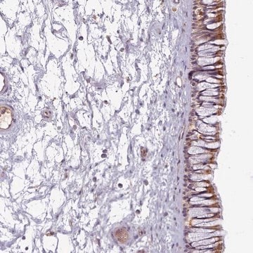 Anti-C1QTNF5 antibody produced in rabbit Prestige Antibodies&#174; Powered by Atlas Antibodies, affinity isolated antibody, buffered aqueous glycerol solution