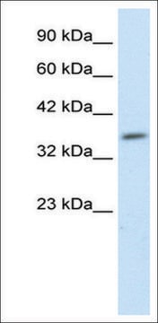 Anti-HEYL antibody produced in rabbit IgG fraction of antiserum